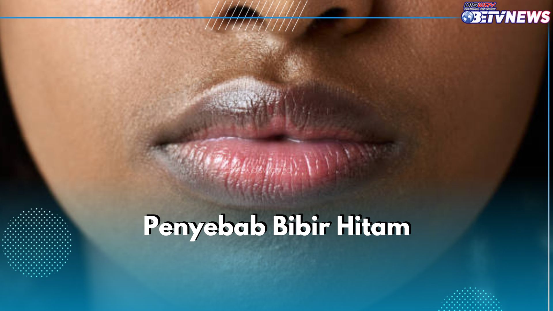 5 Kebiasaan Ini Sebabkan Bibir Jadi Hitam, Apa Saja?