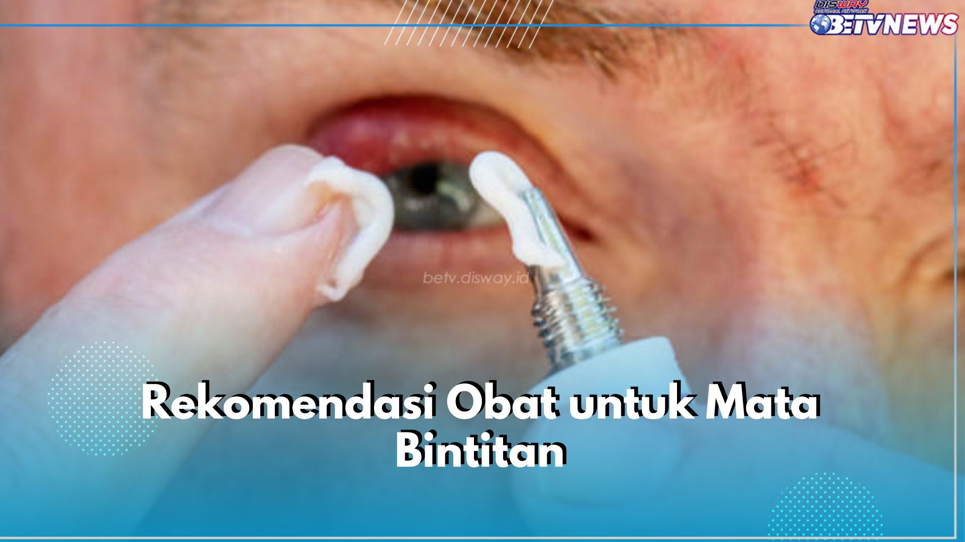 5 Rekomendasi Obat untuk Mata Bintitan,  Ada Salep hingga Obat Tetes