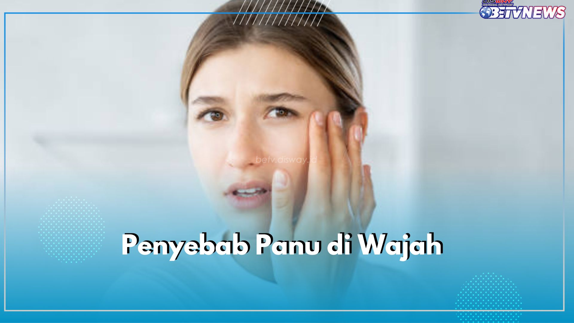 Ketahui 9 Faktor Penyebab Panu di Wajah, Ini Tips Pencegahannya