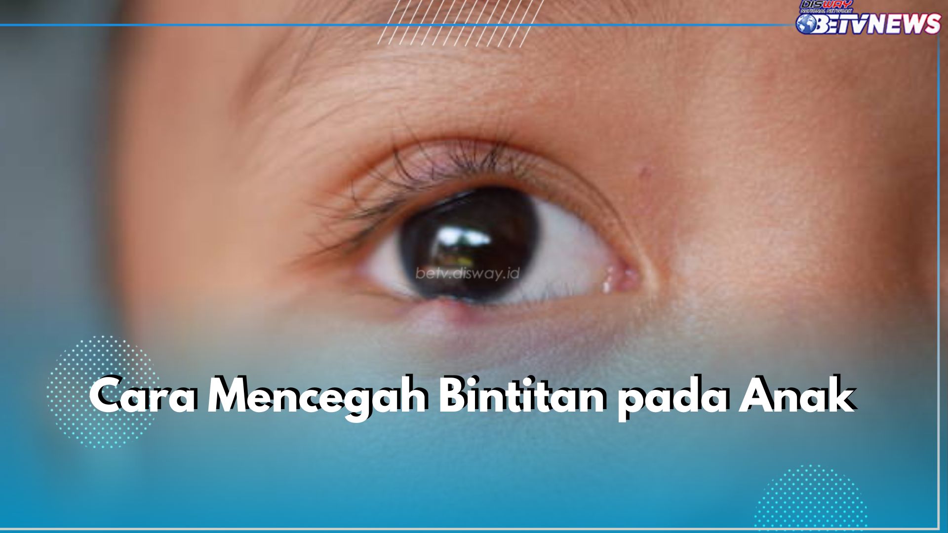 Rentan Terjadi Pada Anak, Cegah Bintitan di Mata dengan 6 Cara Ini