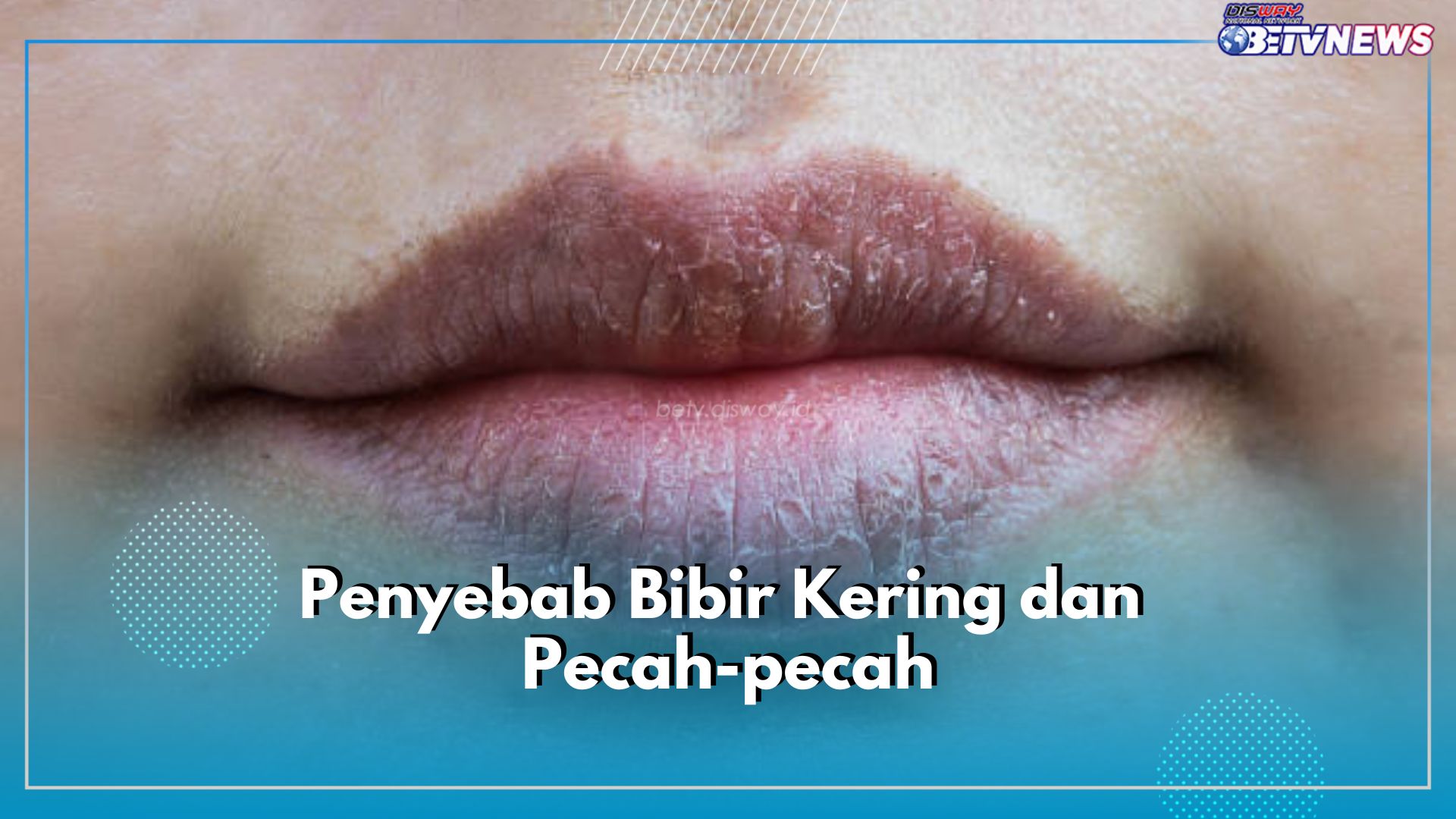 Ini 6 Penyebab Bibir Kering dan Pecah-pecah, Nomor 2 Sering Dilakukan