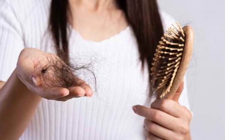 Ini 7 Penyebab Rambut Rontok yang Perlu Diwaspadai, Salah Satunya Stres Berlebihan 