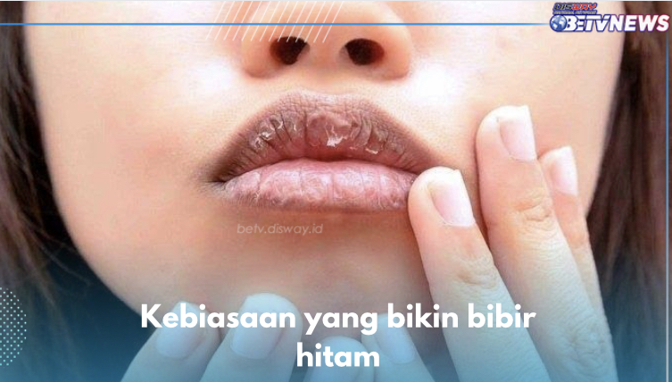 5 Kebiasaan yang Bikin Bibir Hitam, Nomor 1 Sering Dilakukan