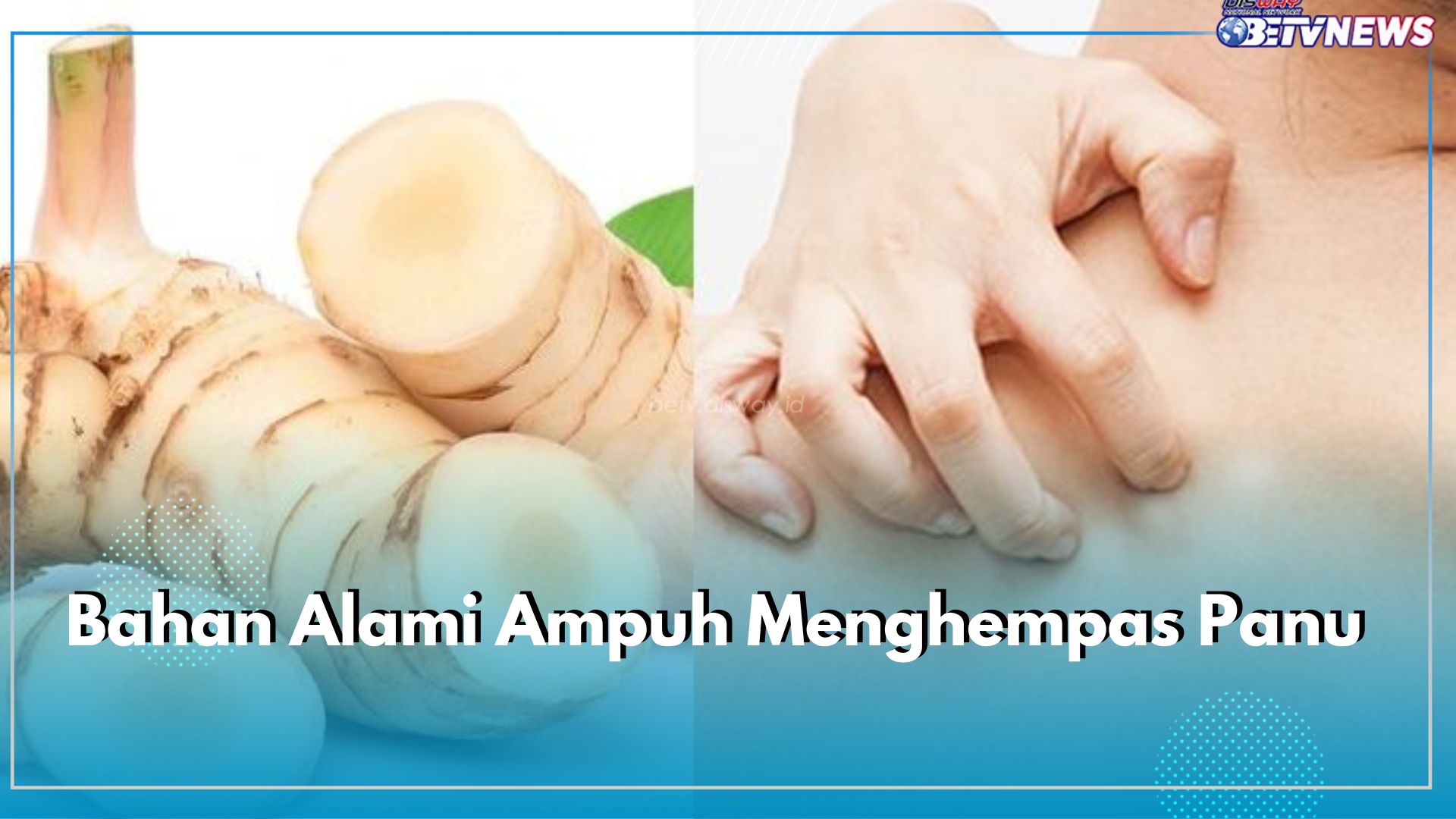 7 Daftar Bahan Alami Ampuh Menghempas Panu Hingga ke Akar, Paling Jitu Pakai Lengkuas hingga Cuka Apel