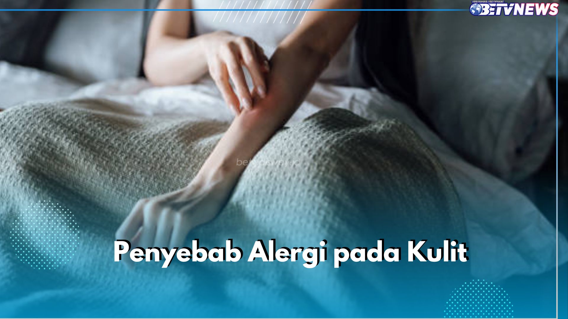 6 Penyebab Alergi pada Kulit yang Perlu Kamu Ketahui, Salah Satunya Paparan Bahan Kimia