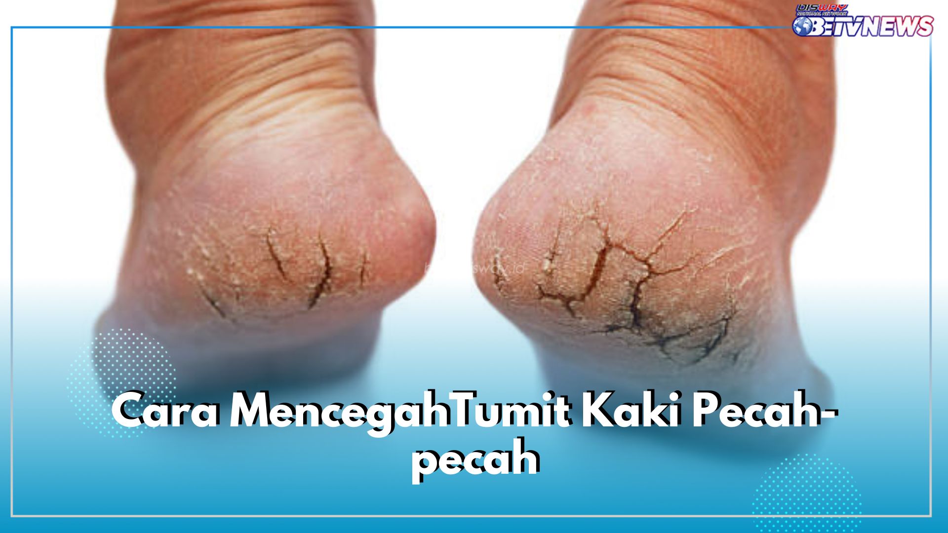 Rutin Eksfoliasi dapat Cegah Tumit Kaki Pecah-Pecah, Cek 5 Cara Lainnya di Sini!