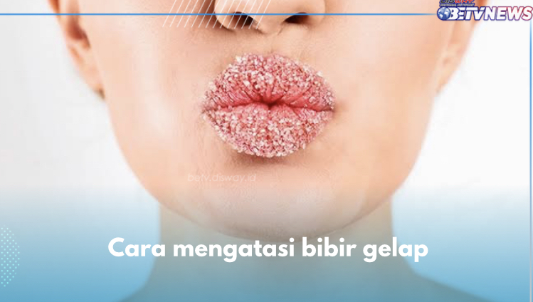 7 Cara Mudah Mengatasi Bibir Hitam, Nomor 3 Hentikan Kebiasaan Merokok