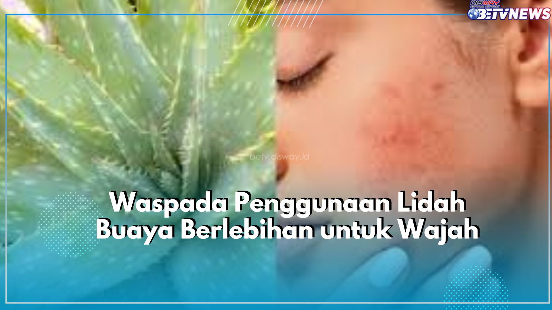 Waspada Berlebihan! Cek Disini Efek Samping Lidah Buaya untuk Kulit Wajah, Picu Timbul Iritasi hingga Alergi
