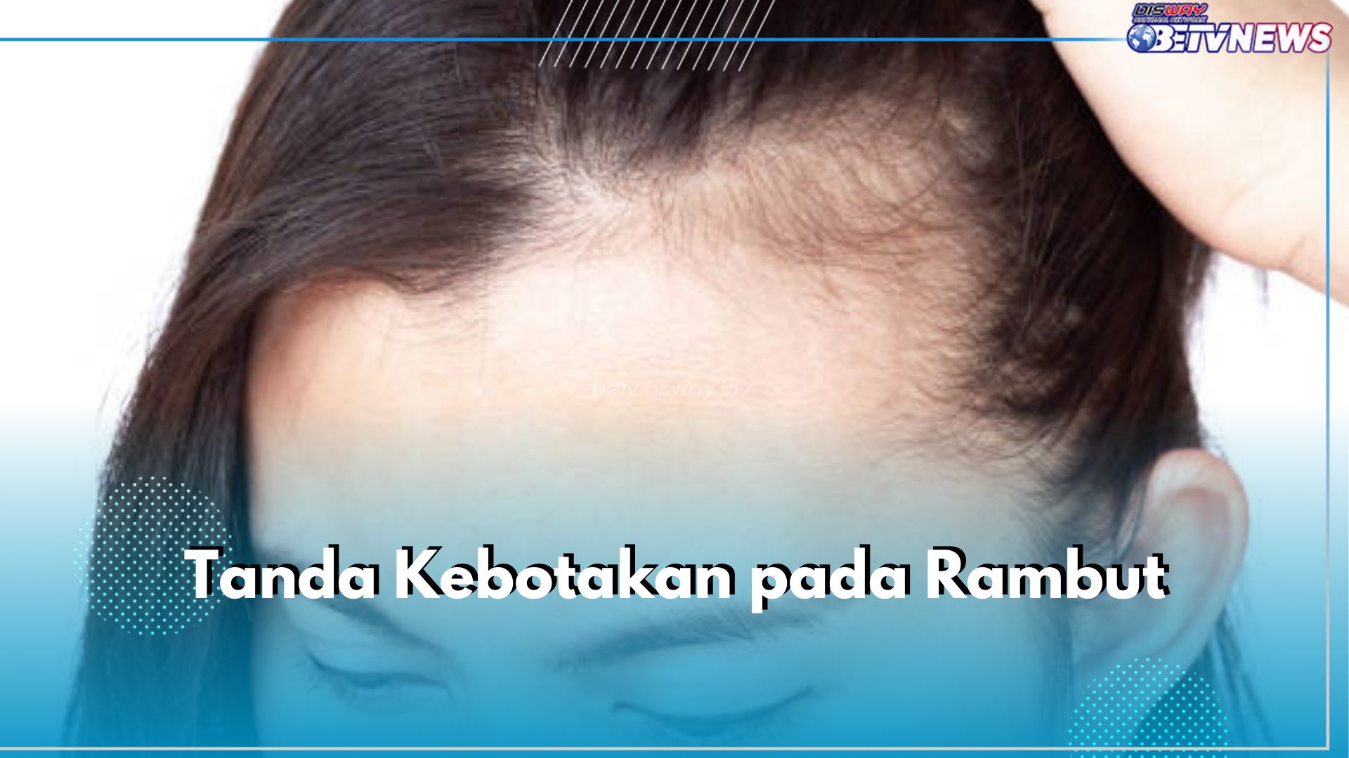 Kenali 7 Tanda Kebotakan pada Rambut Ini dan Atasi Sejak Dini, Salah Satunya Penipisan Rambut