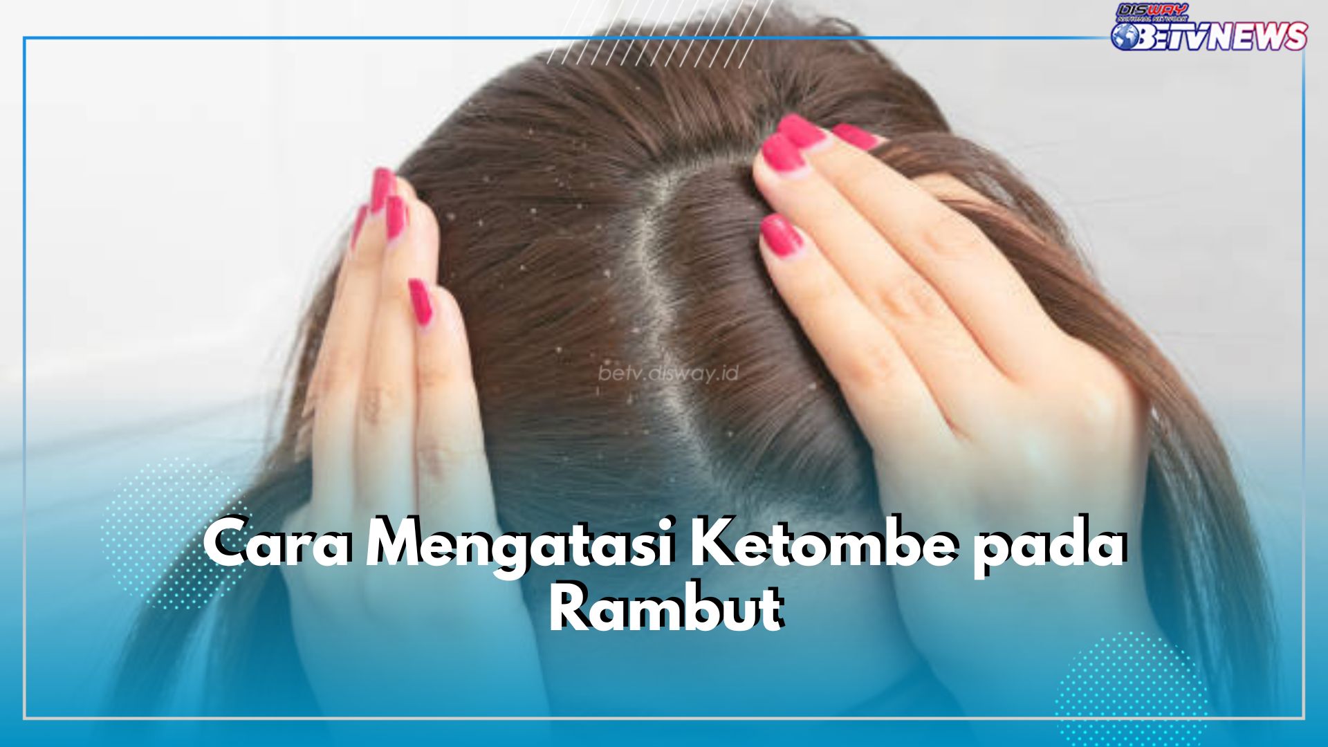 5 Cara Atasi Ketombe pada Rambut Secara Alami, Apa Saja?