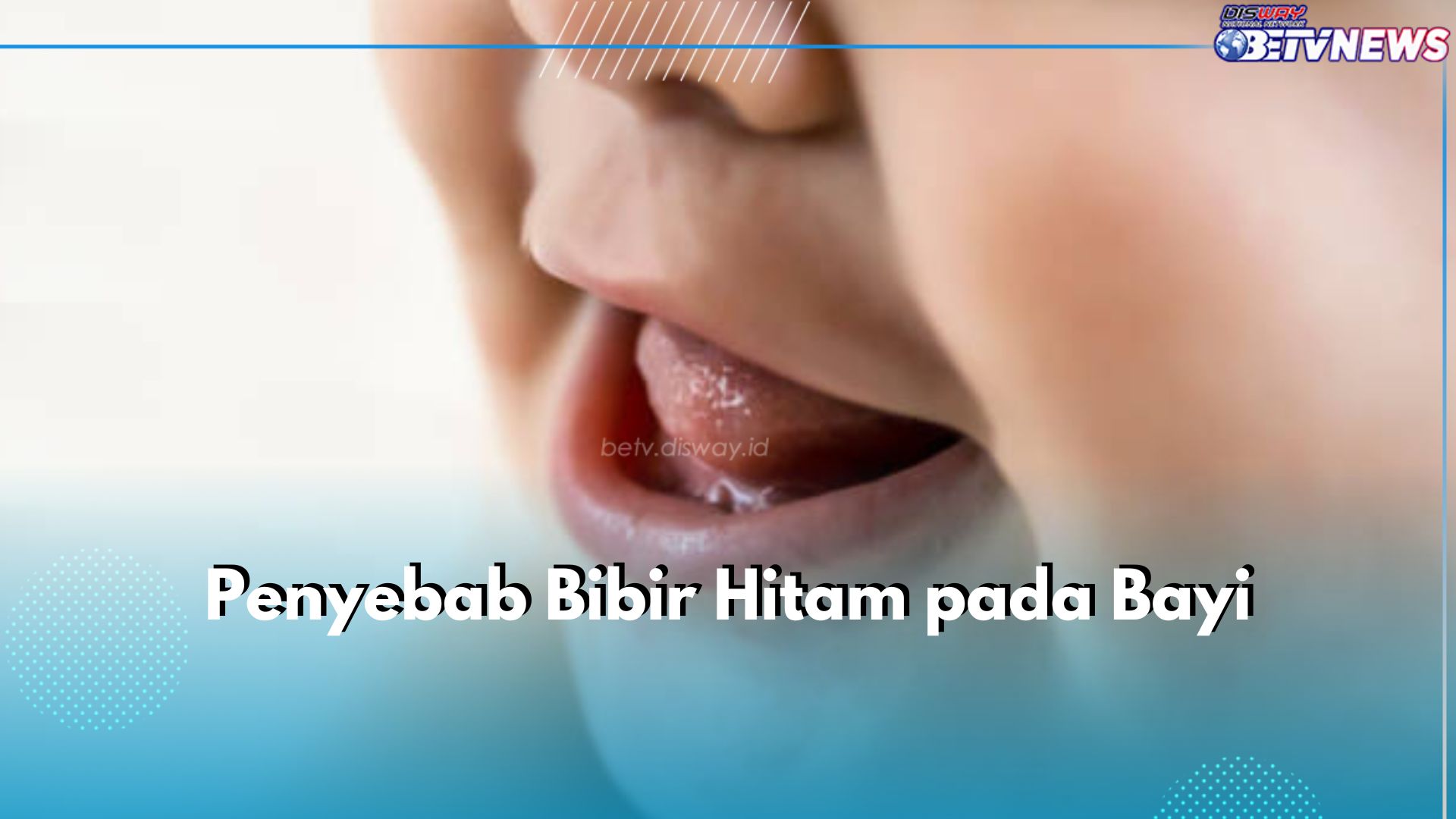 Bibir Bayi Hitam? Kenali 5 Penyebabnya di Sini