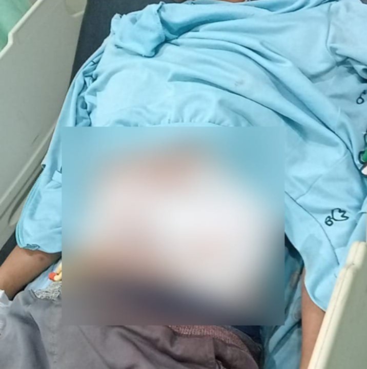 Buruh Harian Ditusuk OTD, HP Hilang dan Harus Menjalani Operasi 