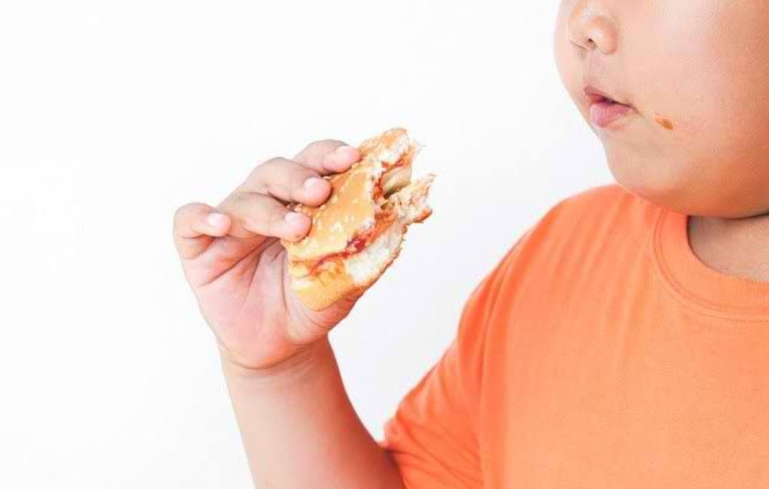 Hati-hati! Simak 3 Faktor Utama Penyebab Obesitas pada Anak