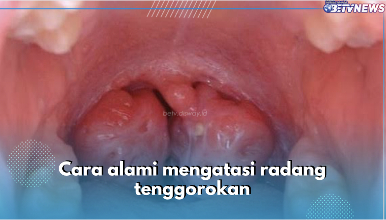 Perbanyak Minum Air hingga Konsumsi Antibiotik, Ini 10 Cara Atasi Radang Tenggorokan