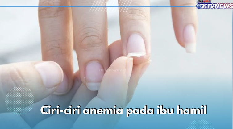 Kuku Kering Selama Hamil Termasuk Ciri-ciri Anemia, Cek Gejala Lainnya di Sini