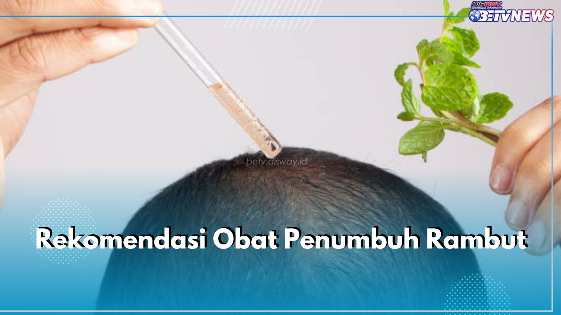 5 Rekomendasi Obat Penumbuh Rambut Ini Bisa Bantu Halau Rontok dan Kebotakan, Ada Minoxidil Salah Satunya