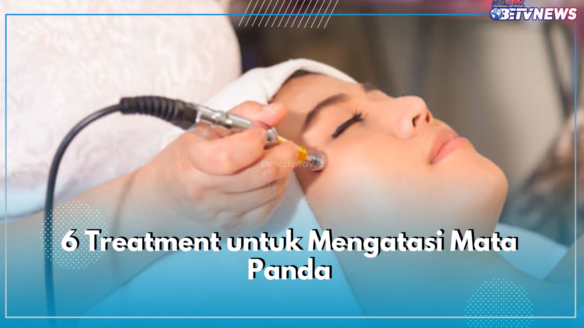 Lakukan 6 Treatment Ini untuk Mengatasi Mata Panda, Lingkaran Hitam Auto Bye-bye Selamanya!