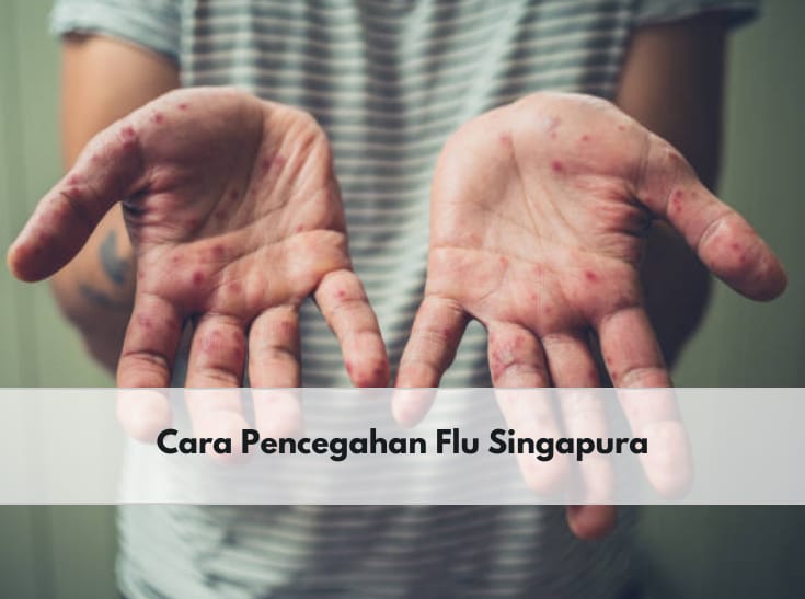 Semakin Marak Terjadi, Ini 5 Cara Efektif untuk Mencegah Flu Singapura pada Anak, Apa Saja?