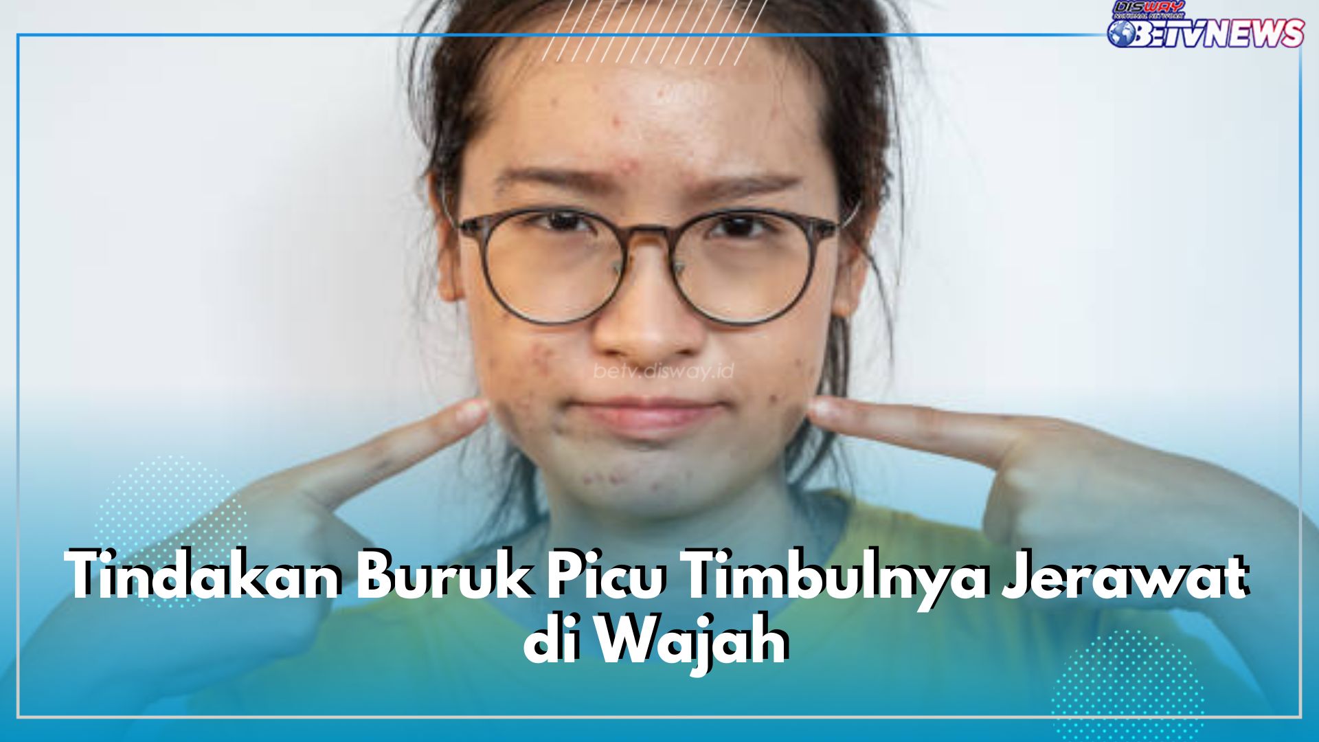 5 Tindakan Buruk Picu Timbulnya Jerawat di Wajah, Auto Gagal Glowing, Cek di Sini