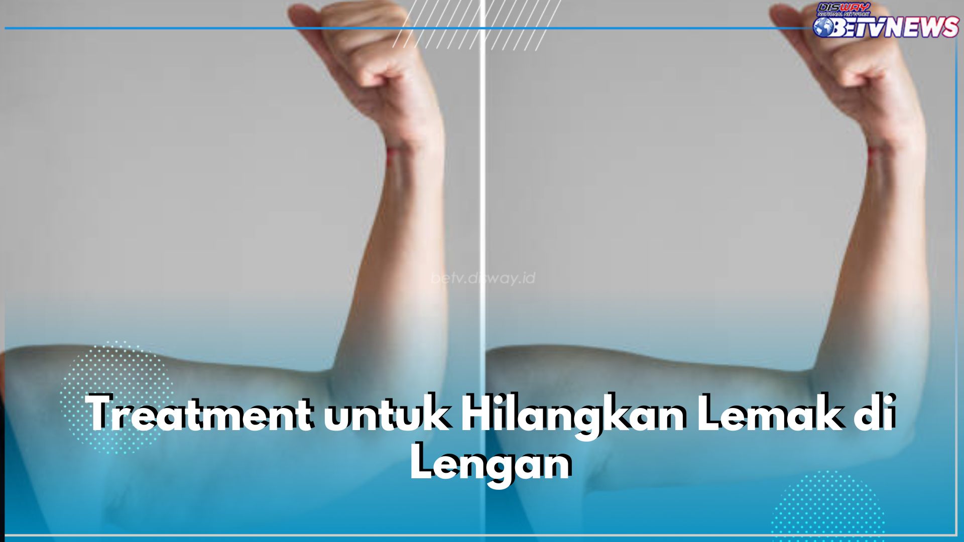 Ini 5 Treatment untuk Hilangkan Lemak di Lengan, Ingin Coba?