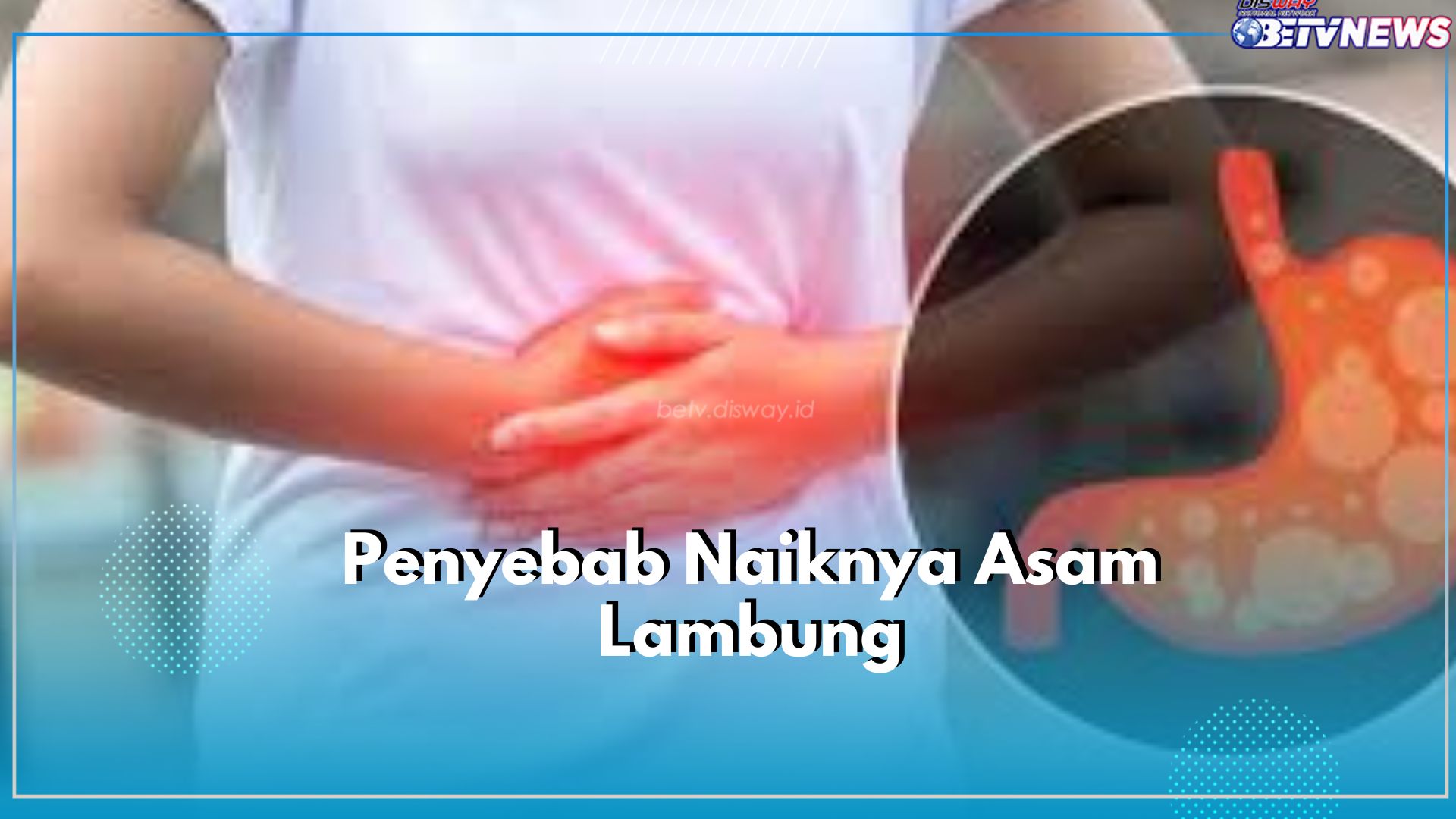 Rasa Stres dan Cemas Dapat Memicu Naiknya Asam Lambung, Cek 5 Penyebab Lainnya Disini!