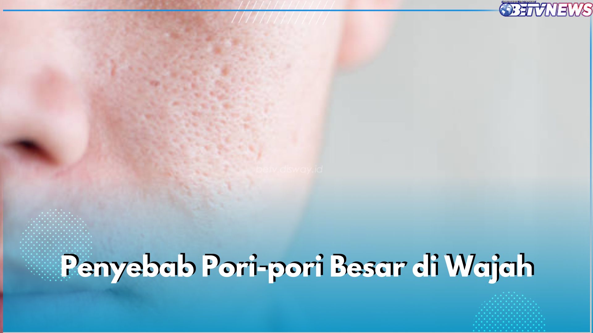 5 Penyebab Pori-Pori Besar di Wajah, Salah Satunya Produksi Minyak Berlebih