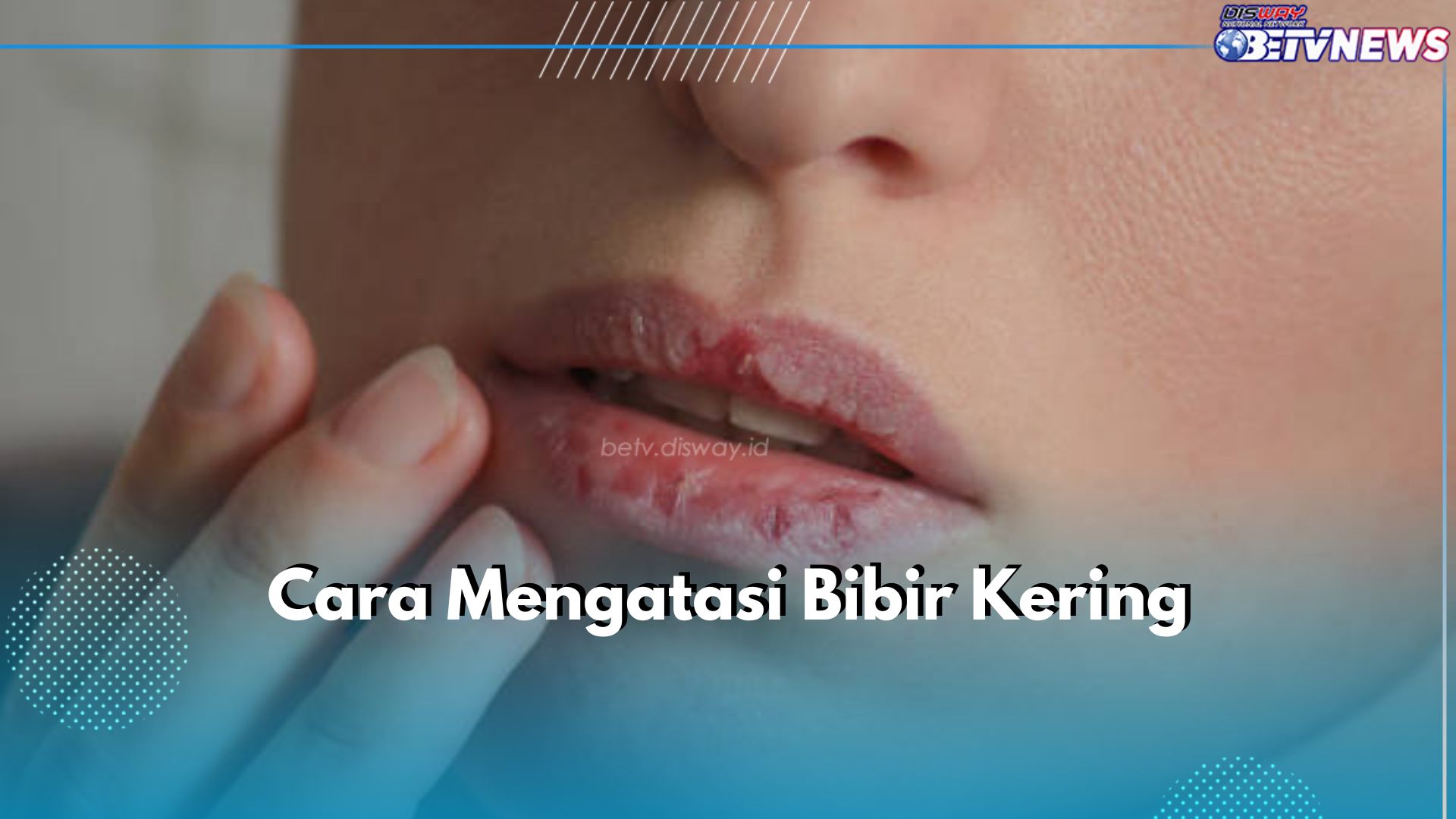 Bibirmu Kering? Atasi dengan 5 Cara Mudah Ini, Bibir Jadi Lembap Seketika