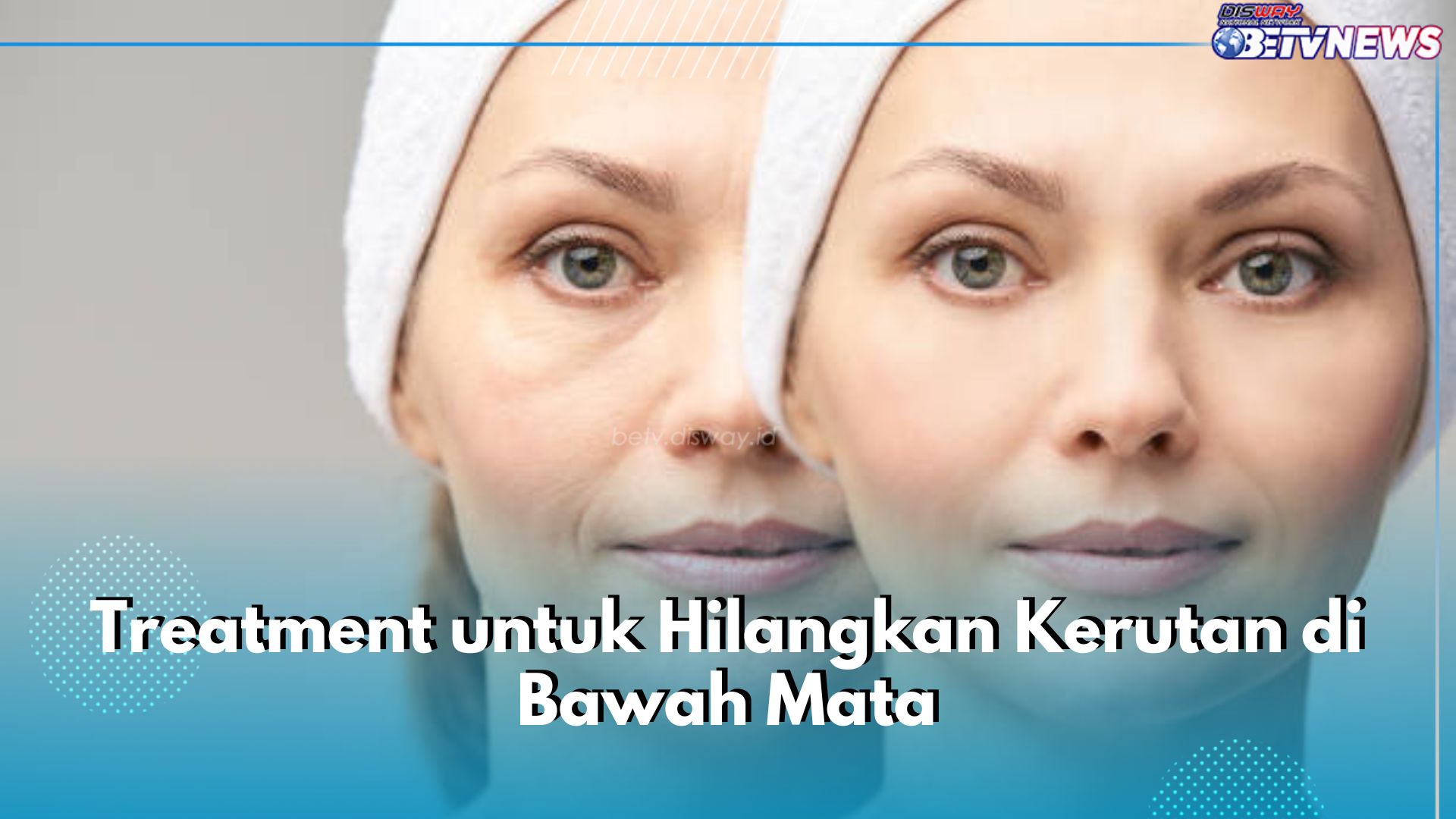 5 Treatment untuk Hilangkan Kerutan di Bawah Mata, Salah Satunya Botox