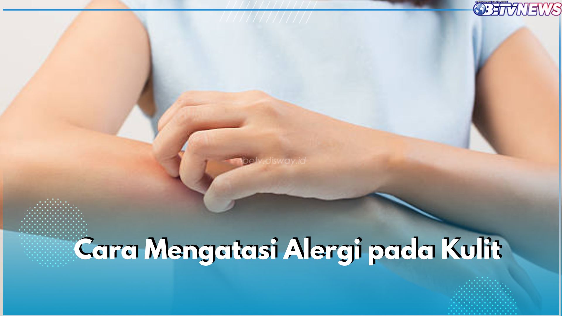 5 Cara Atasi Alergi pada Kulit, Salah Satunya Penggunaan Antihistamin