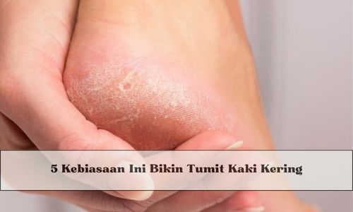 5 Kebiasaan Ini Bikin Tumit Kaki Kering, Kamu Wajib Tahu Untuk Menghindarinya, Yuk Cari Tahu di Sini