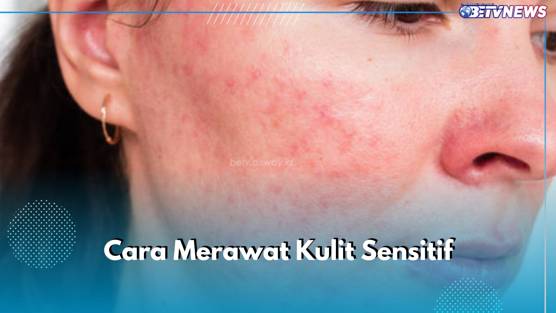  Jangan Asal! Rawat Kulit Sensitif dengan 5 Cara Ini, Pilih Produk Skincare Berlabel Hypoallergenic