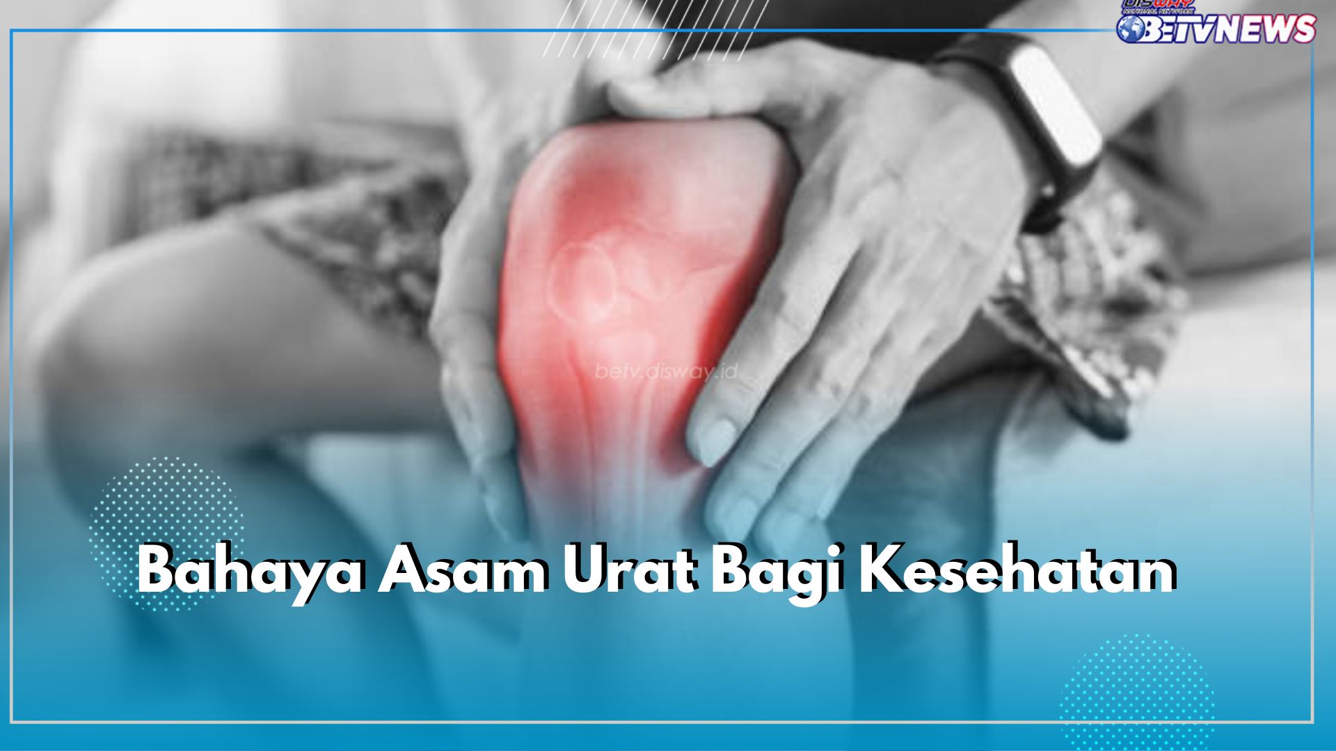 Jangan Dibiarkan Begitu Saja, Ini 5 Bahaya Asam Urat Bagi Kesehatan Jika Tidak Diobati dengan Baik