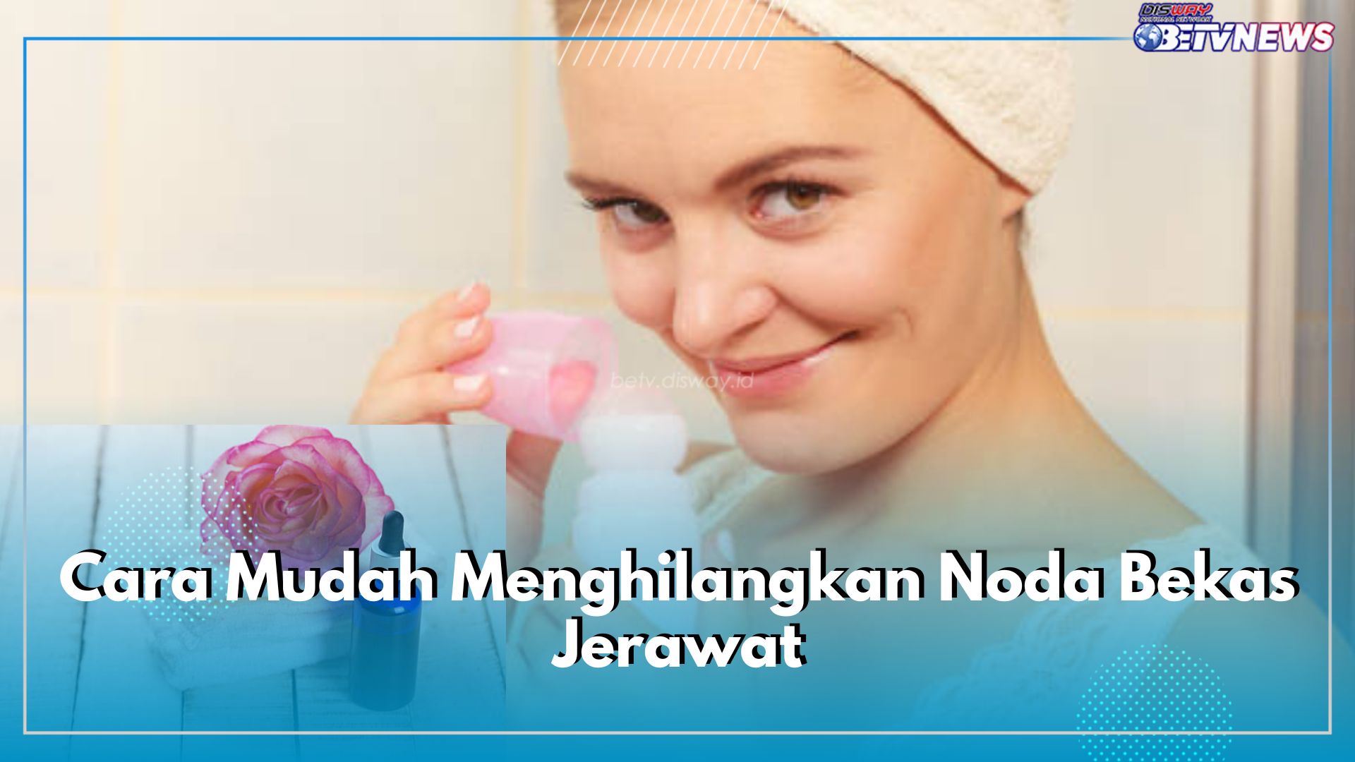 Cara Mudah Menghilangkan Noda Bekas Jerawat, Cukup Gunakan Air Mawar dan 5 Bahan Alami Ini