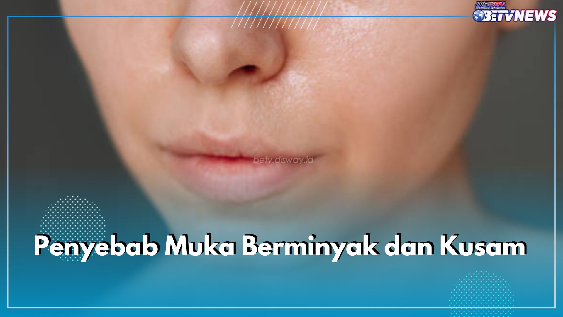 Inilah 7 Penyebab Muka Berminyak dan Kusam yang Wajib Kamu Waspadai, Apa Saja? Cek di Sini