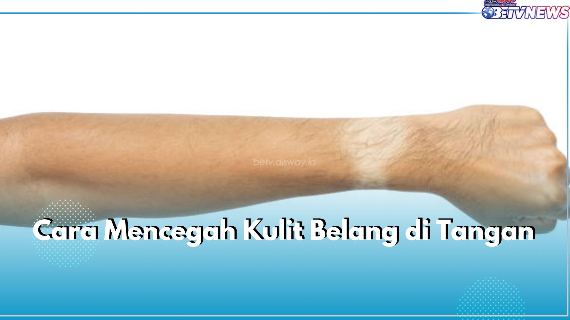 6 Cara Cegah Kulit Belang di Tangan, Salah Satunya Harus Rutin Pakai Sunscreen