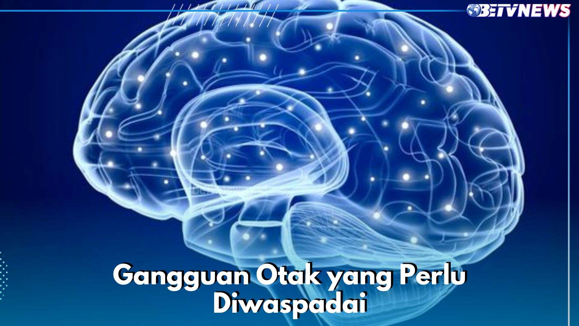 Hati-hati, Ini 6 Gangguan Otak yang Perlu Diwaspadai, Ada Epilepsi hingga Ataxia