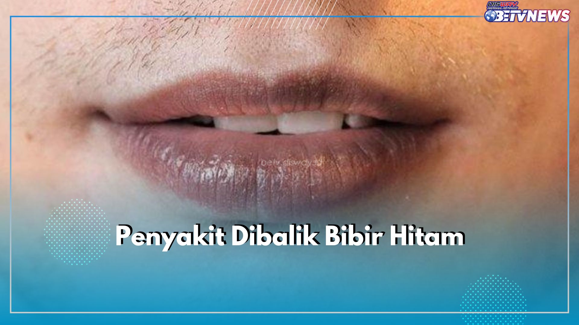 Jangan Abaikan Bibir Hitam Karena Bisa Jadi Tanda 4 Penyakit Ini, Cek Apa Saja!