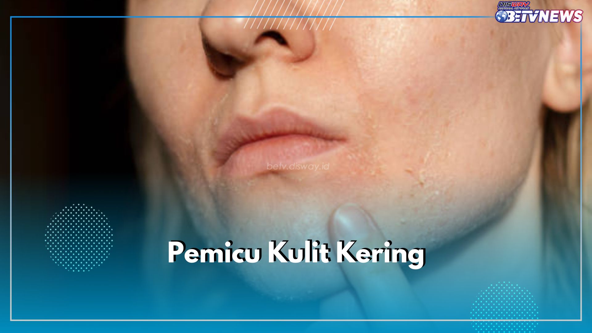 Kulit Kering Dapat Dipicu oleh 7 Kebiasaan Buruk Ini, Apa Saja?