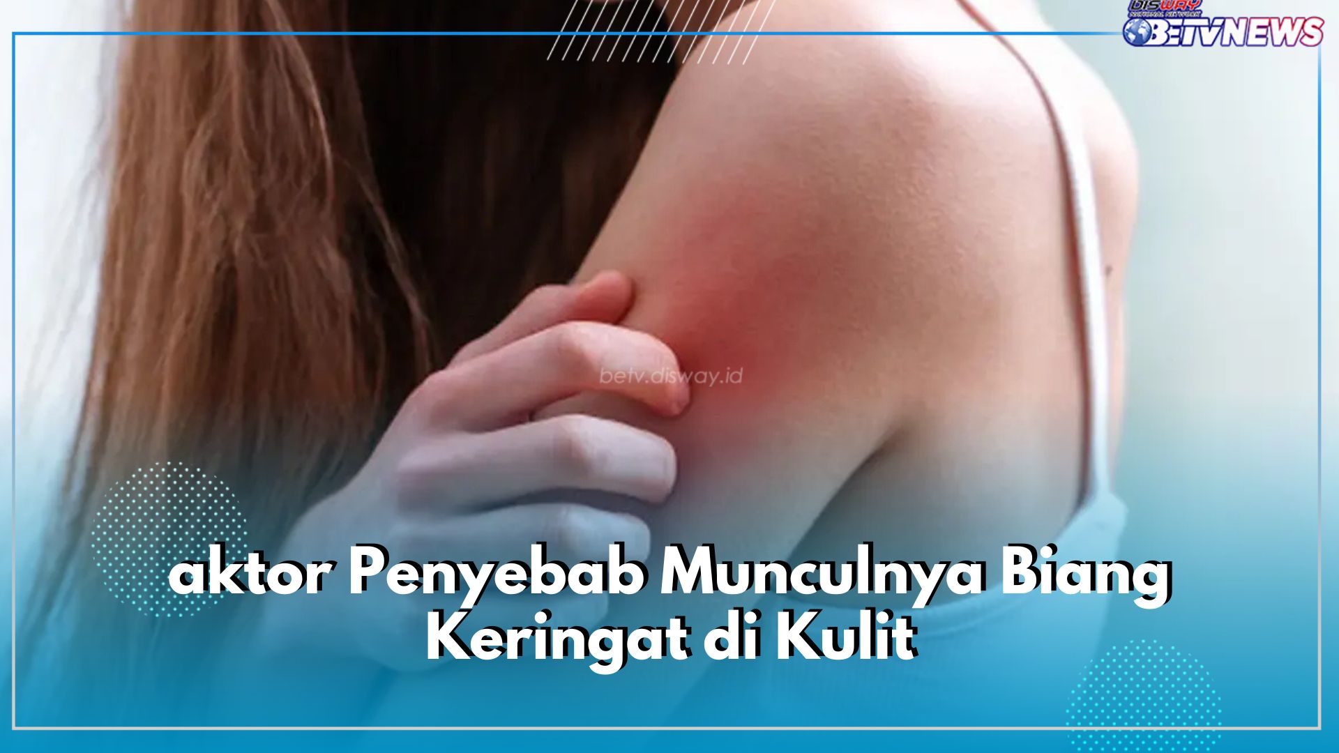 Kenali 5 Faktor Penyebab Munculnya Biang Keringat di Kulit, Alasan Nomor 2 Paling Tidak Terduga