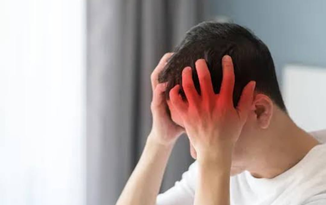 5 Cara Sederhana Mengatasi Migrain Tanpa Obat