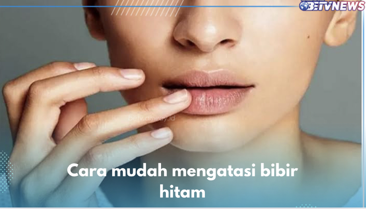 Ini 7 Cara Mudah Mengatasi Bibir Hitam, Salah Satunya Kurangi Asupan Kafein