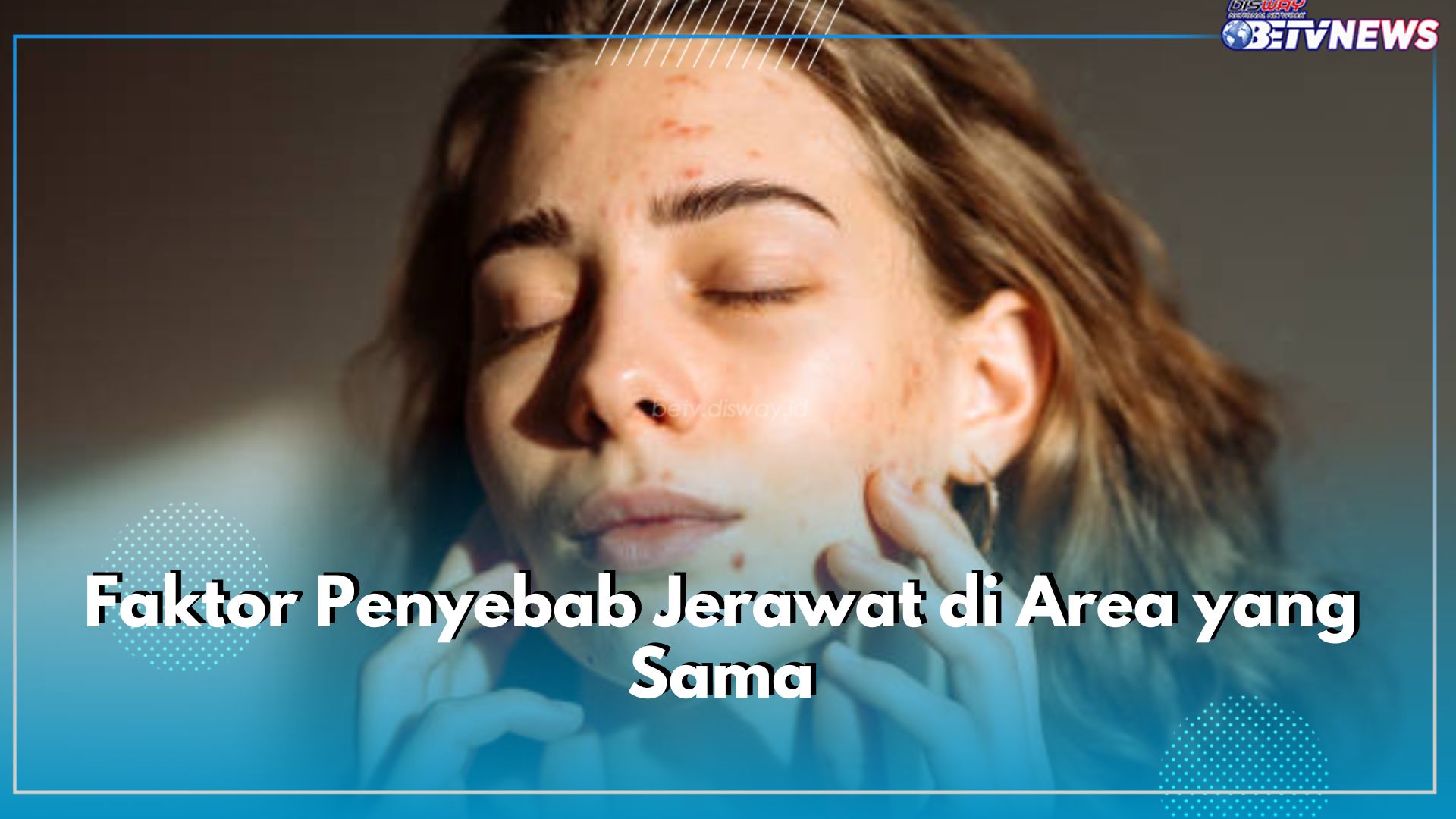 Pusing Jerawat Muncul Ditempat yang Sama? Mungkin Ini 4 Faktor Penyebabnya, Buruan Cek dan Pastikan!
