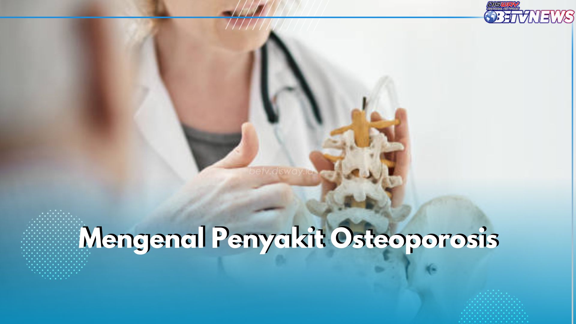 Mengenal Osteoporosis, Pengeroposan Tulang yang Sering Lambat Disadari, Apa Itu?