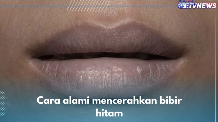 5 Cara Alami Cerahkan Bibir Hitam, Nomor 1 Gunakan Madu dan Gula