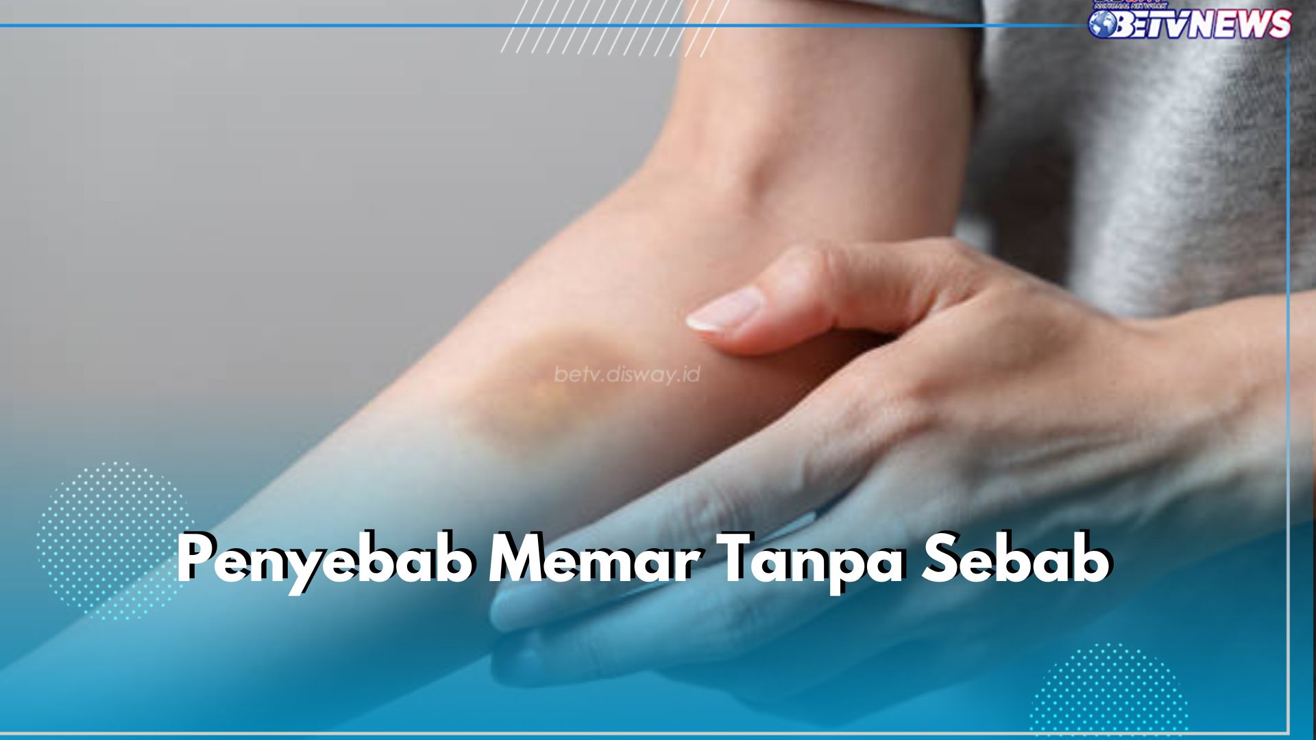 Bingung Karena Memar Sering Muncul Tanpa Sebab? Ternyata Ini 6 Penyebabnya, Cek Apa Saja!