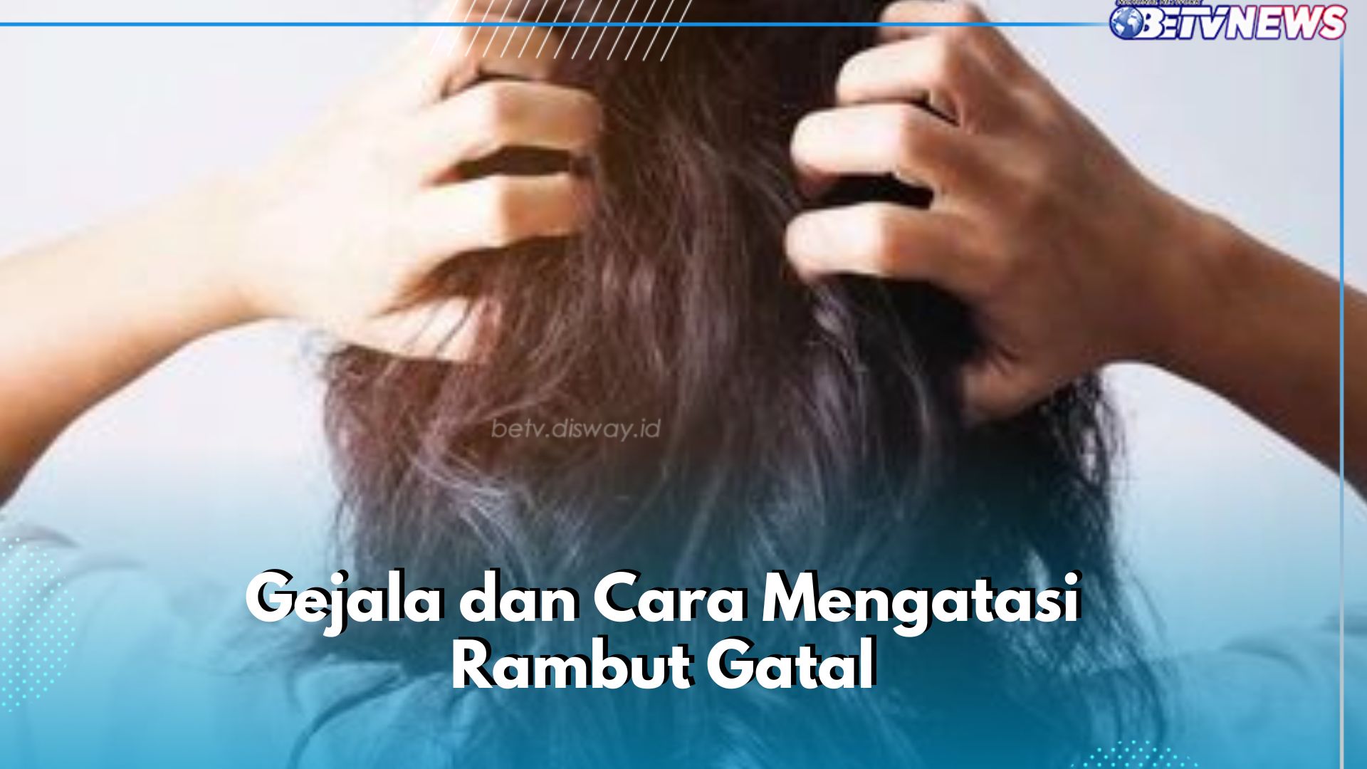 Cek di Sini! Rambut Gatal Bikin Gak Nyaman, Ini Gejala yang Bisa Kamu Alami dan Cara Mengatasinya