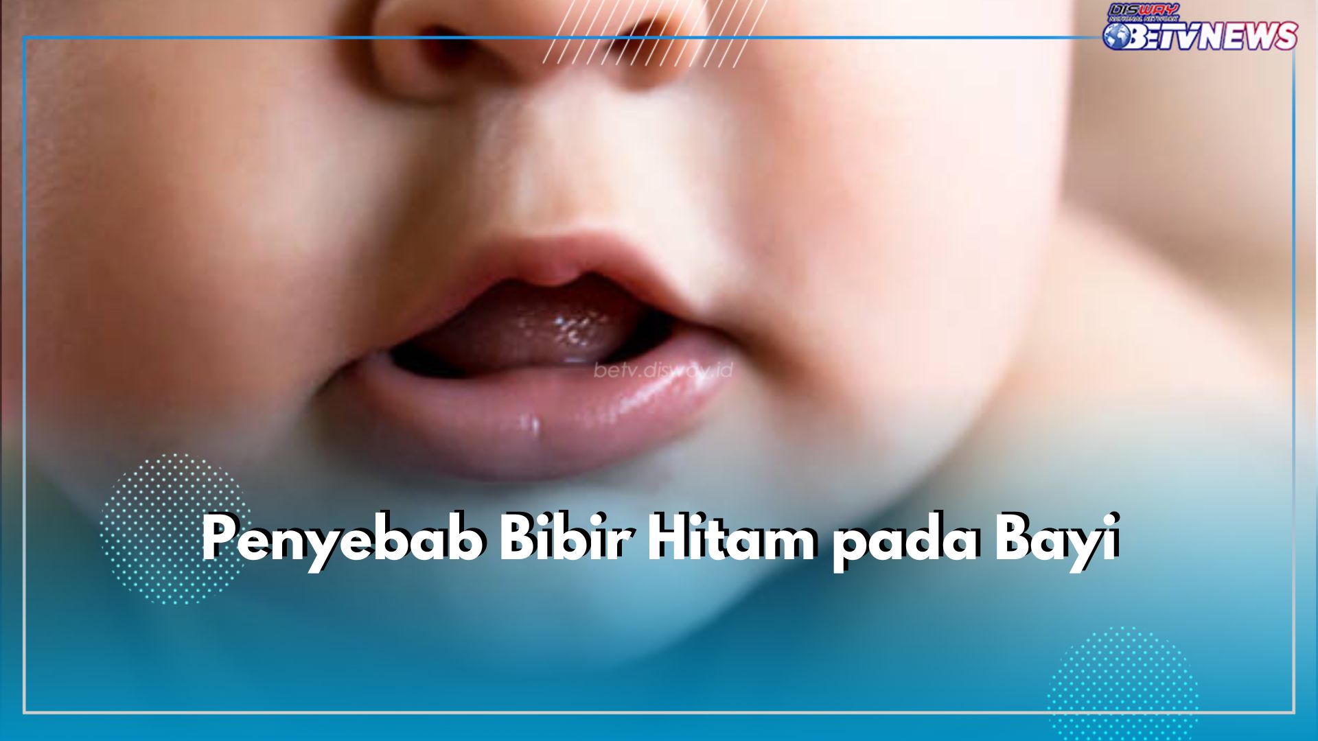 Ini 5 Penyebab Bibir Hitam pada Bayi yang Perlu Diketahui Orang Tua, Salah Satunya Cedera