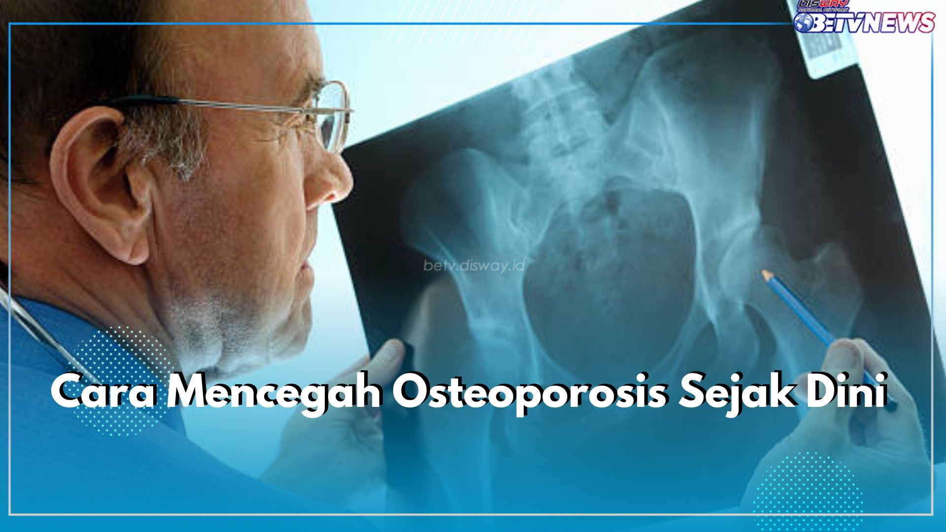 5 Cara Mencegah Osteoporosis Sejak Dini, Lakukan Sebelum Terlambat!