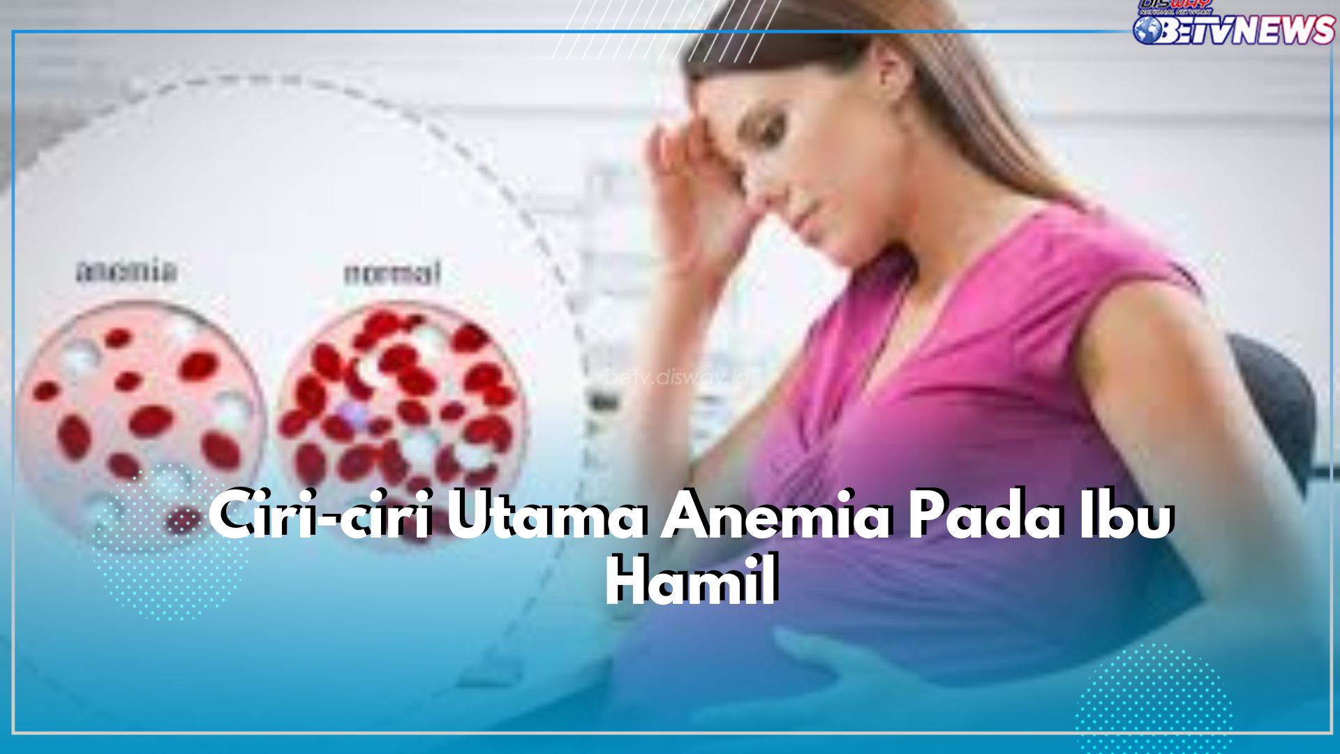 Jangan Anggap Sepele! Ini Ciri-ciri Utama Anemia Pada Ibu Hamil, Wasapada Dapat Terjadi Kapanpun