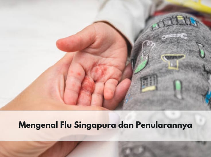 Mengenal Flu Singapura yang Kerap Menyerang Anak-anak, Bagaimana Penularannya? Cek Segera!